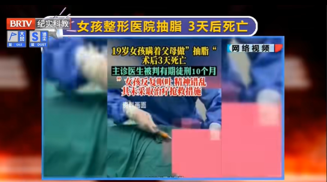 京云律師解讀：19歲女孩整形醫院抽脂后3天死亡，主診醫生獲刑！